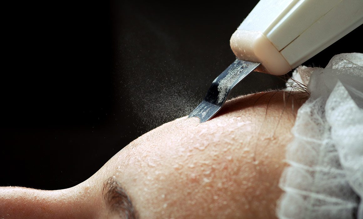 4 Facial Treatments