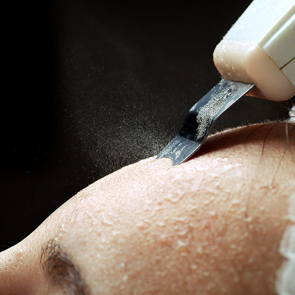 Facial Treatments